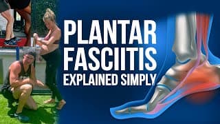 Plantar Fasciitis Explained Simply